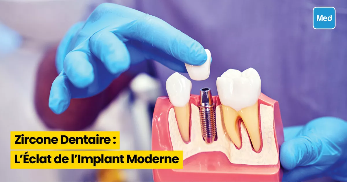 Zircone Dentaire : L'Éclat de l'Implant Moderne
